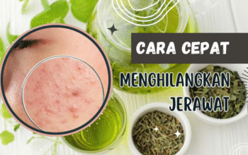 Cara Ampuh Terbaru Menghilangkan Jerawat Secara Alami