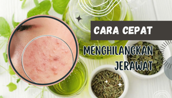 Cara Ampuh Terbaru Menghilangkan Jerawat Secara Alami