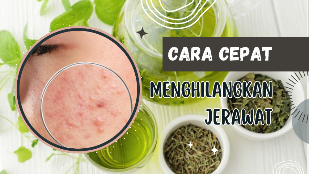 Cara Ampuh Terbaru Menghilangkan Jerawat Secara Alami